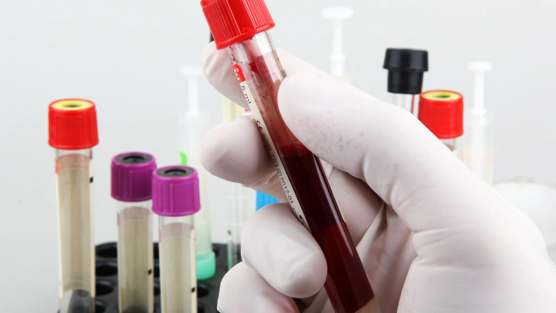 Lipase Test